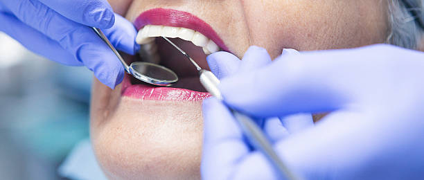 Best Broken or Chipped Tooth Repair in Morgantown, WV