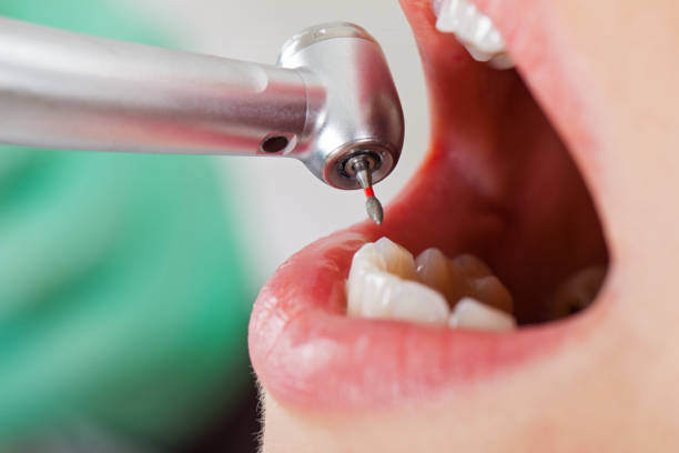 Best Emergency Treatment for Oral Infections in Morgantown, WV